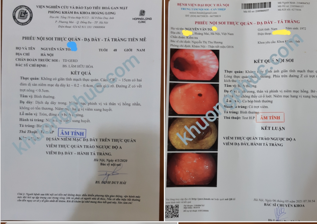thuốc nam đặc trị chữa khỏi bệnh chuyển sản ruột, dị sản ở dạ dày.