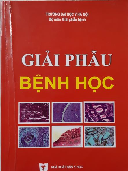 Bệnh thoát vị đĩa đệm - đau thần kinh tọa và thuốc chữa