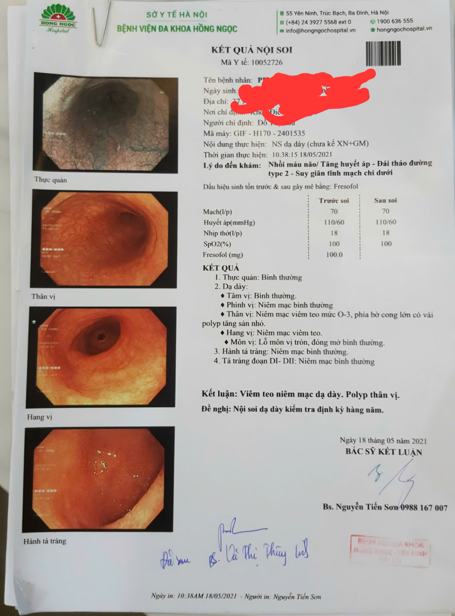 Viêm teo niêm mạc dạ dày có chữa khỏi không?