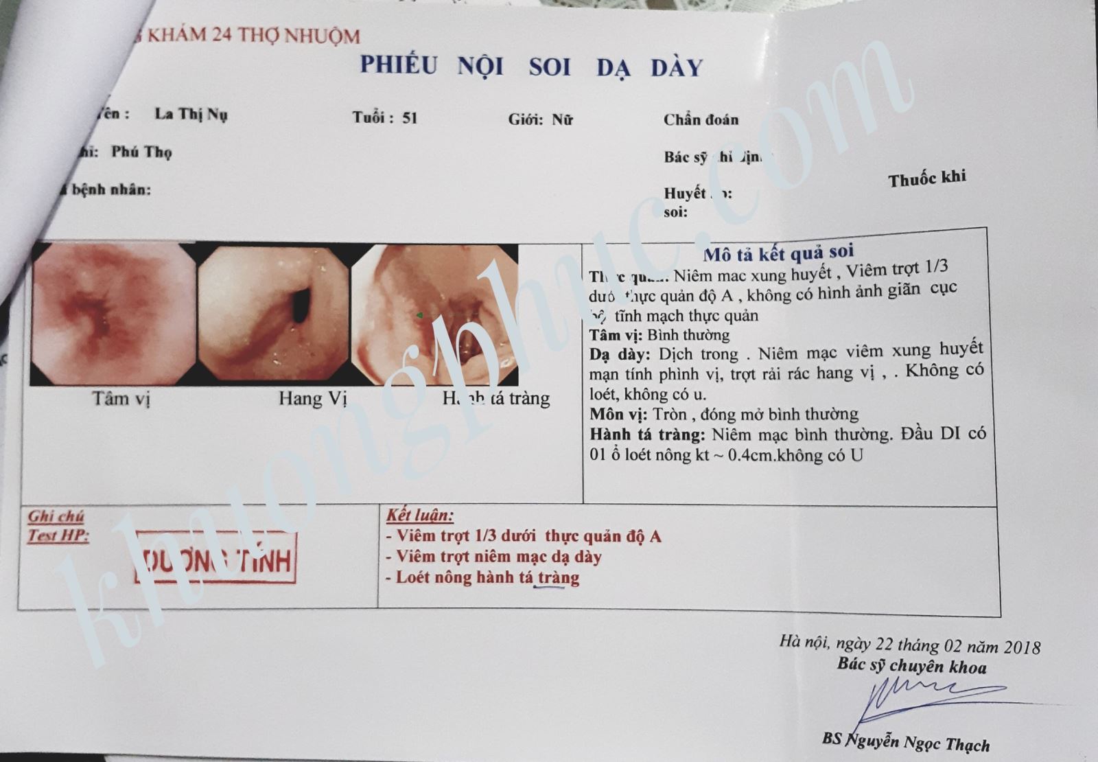 trào ngược dạ dày thực quản