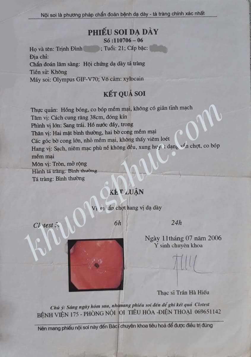 viêm trợt, phù nề, xung huyết hang vị